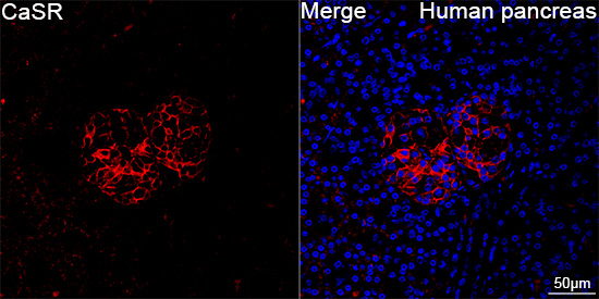Calcium Sensing Receptor Antibody in Immunohistochemistry (Paraffin) (IHC (P))