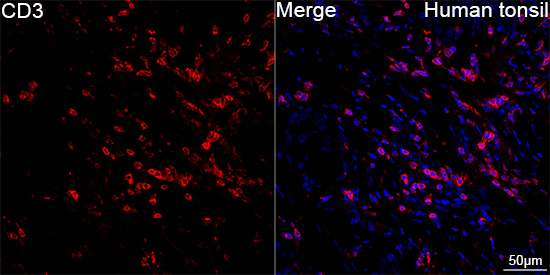 CD3 Antibody in Immunohistochemistry (Paraffin) (IHC (P))