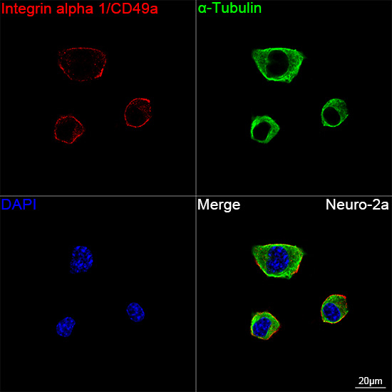 CD49a Antibody in Immunocytochemistry (ICC/IF)