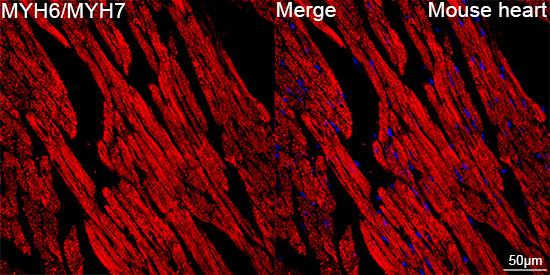 MYH6/MYH7 Antibody in Immunohistochemistry (Paraffin) (IHC (P))