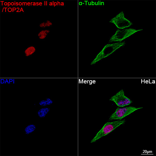 TOP2A Antibody in Immunocytochemistry (ICC/IF)