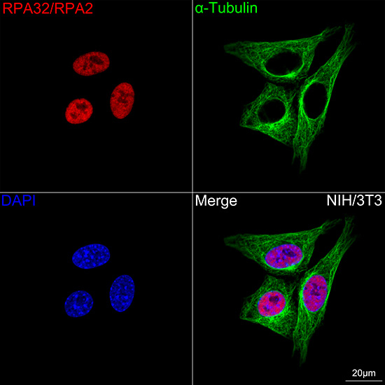 RPA2 Antibody in Immunocytochemistry (ICC/IF)