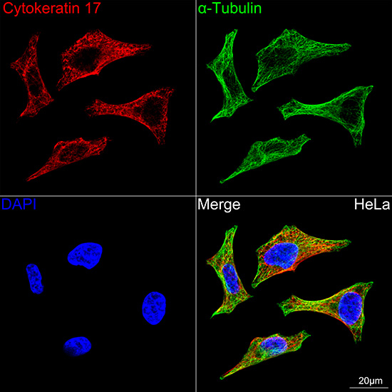Cytokeratin 17 Antibody in Immunocytochemistry (ICC/IF)