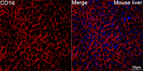 CD1d Antibody in Immunohistochemistry (Paraffin) (IHC (P))