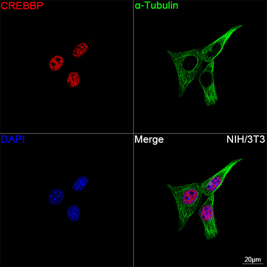 CBP Antibody in Immunocytochemistry (ICC/IF)