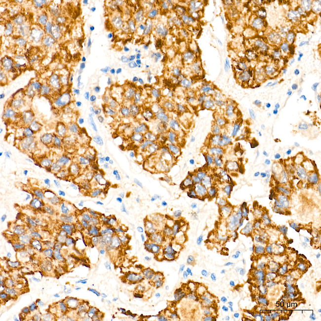 LYPLA1 Antibody in Immunohistochemistry (Paraffin) (IHC (P))