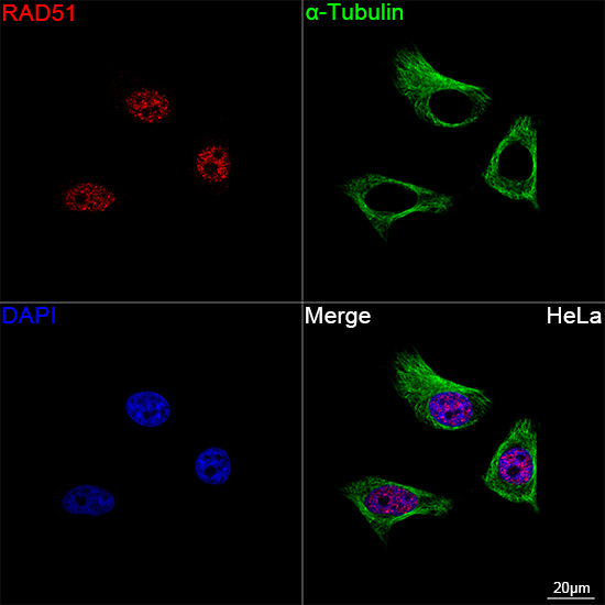 RAD51 Antibody in Immunocytochemistry (ICC/IF)