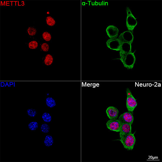 METTL3 Antibody in Immunocytochemistry (ICC/IF)
