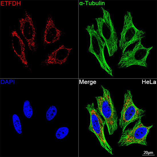 ETFDH Antibody in Immunocytochemistry (ICC/IF)