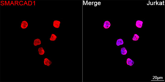 SMARCAD1 Antibody in Immunocytochemistry (ICC/IF)