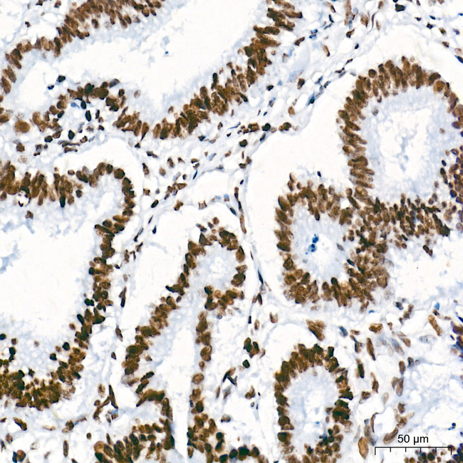 H4K8ac Antibody in Immunohistochemistry (Paraffin) (IHC (P))