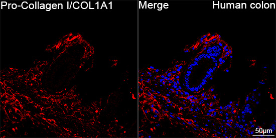 COL1A1 Antibody in Immunohistochemistry (Paraffin) (IHC (P))