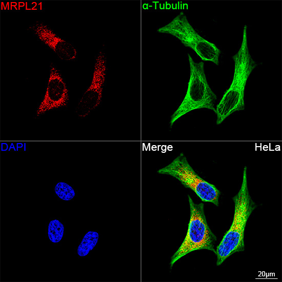 MRPL21 Antibody in Immunocytochemistry (ICC/IF)