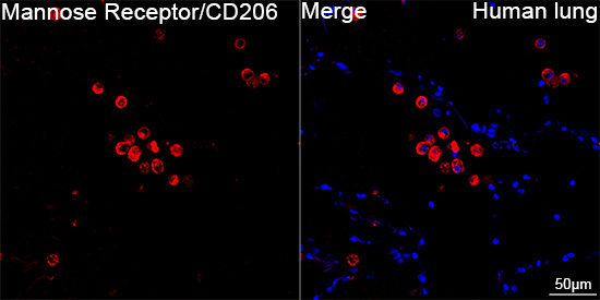 CD206 Antibody in Immunohistochemistry (Paraffin) (IHC (P))