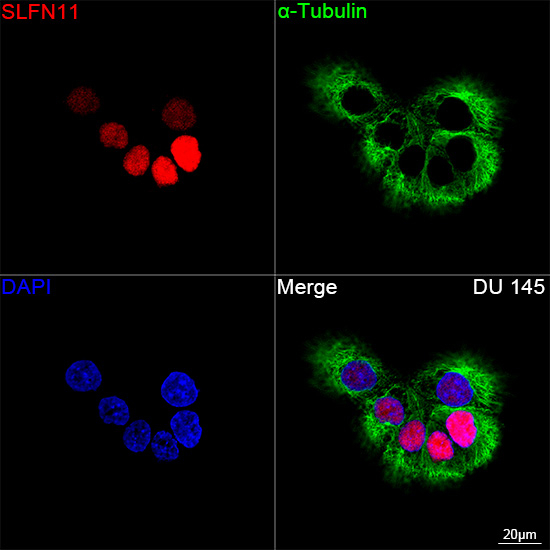 SLFN11 Antibody in Immunocytochemistry (ICC/IF)