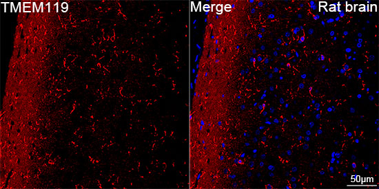 TMEM119 Antibody in Immunohistochemistry (Paraffin) (IHC (P))