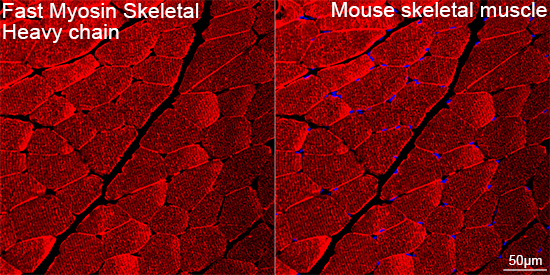 MYH1 Antibody in Immunohistochemistry (Paraffin) (IHC (P))