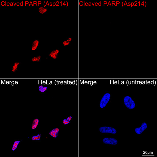 PARP1 (cleaved Asp214) Antibody in Immunocytochemistry (ICC/IF)