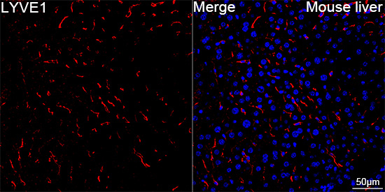 LYVE1 Antibody in Immunohistochemistry (Paraffin) (IHC (P))