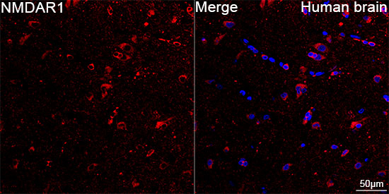 NMDAR1 Antibody in Immunohistochemistry (Paraffin) (IHC (P))