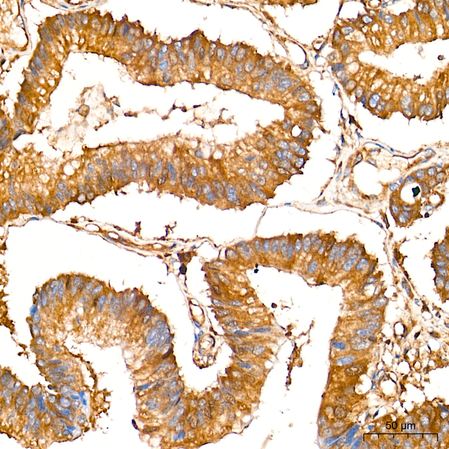 LAP3 Antibody in Immunohistochemistry (Paraffin) (IHC (P))