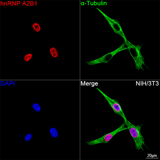 hnRNP A2B1 Antibody in Immunocytochemistry (ICC/IF)