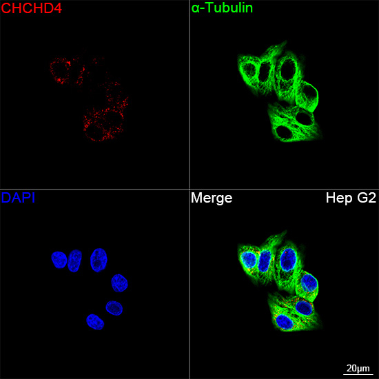 CHCHD4 Antibody in Immunocytochemistry (ICC/IF)