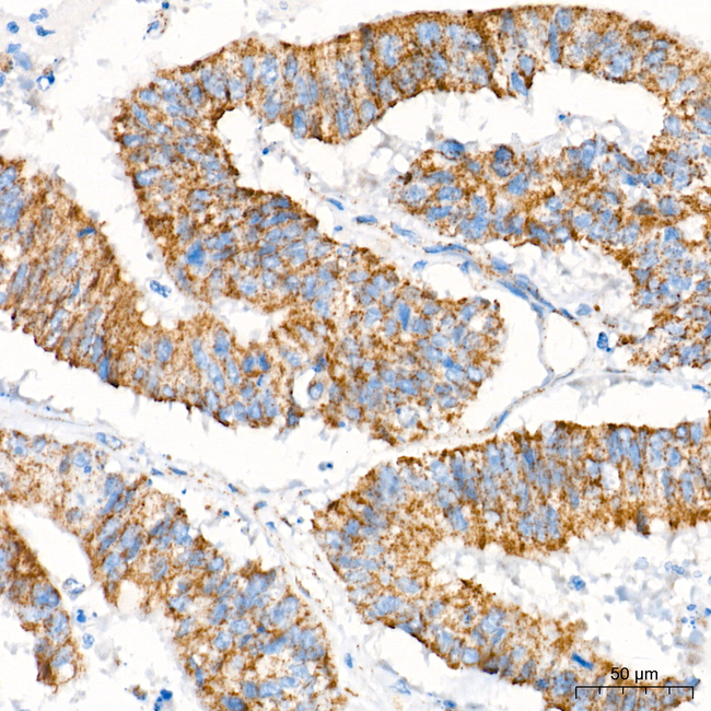 MECR Antibody in Immunohistochemistry (Paraffin) (IHC (P))