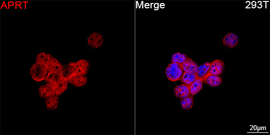 APRT Antibody in Immunocytochemistry (ICC/IF)