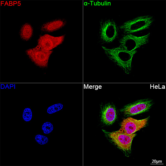 FABP5 Antibody in Immunocytochemistry (ICC/IF)