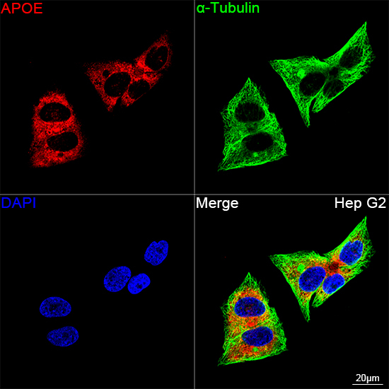 APOE Antibody in Immunocytochemistry (ICC/IF)
