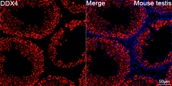 DDX4 Antibody in Immunohistochemistry (Paraffin) (IHC (P))