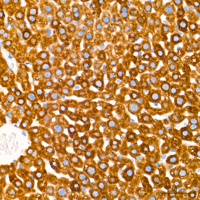 HSD17B2 Antibody in Immunohistochemistry (Paraffin) (IHC (P))