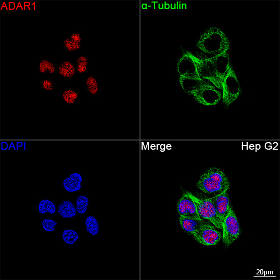 ADAR1 Antibody in Immunocytochemistry (ICC/IF)