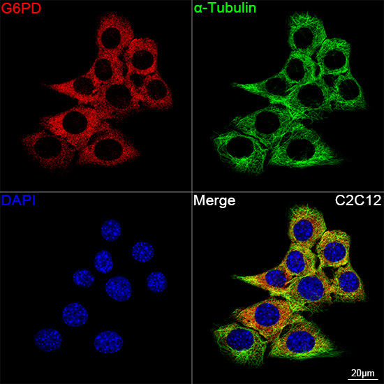 G6PD Antibody in Immunocytochemistry (ICC/IF)