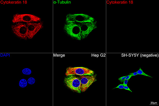 Cytokeratin 18 Antibody in Immunocytochemistry (ICC/IF)