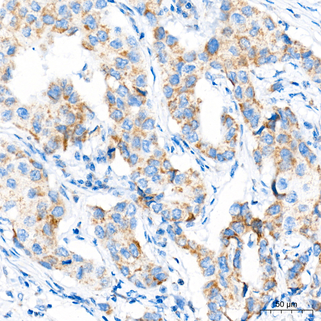 C14orf159 Antibody in Immunohistochemistry (Paraffin) (IHC (P))