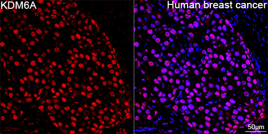 KDM6A Antibody in Immunohistochemistry (Paraffin) (IHC (P))