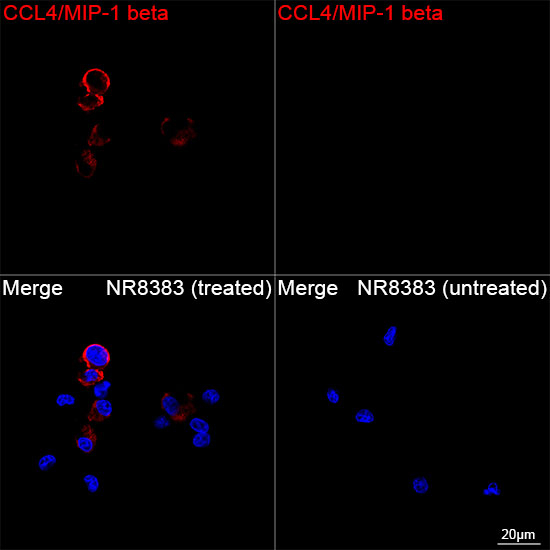CCL4 Antibody in Immunocytochemistry (ICC/IF)