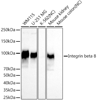 ITGB8 Antibody in Western Blot (WB)