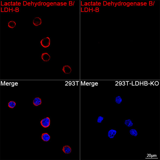 LDHB Antibody in Immunocytochemistry (ICC/IF)