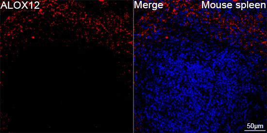 ALOX12 Antibody in Immunohistochemistry (Paraffin) (IHC (P))