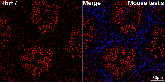 RBM7 Antibody in Immunohistochemistry (Paraffin) (IHC (P))