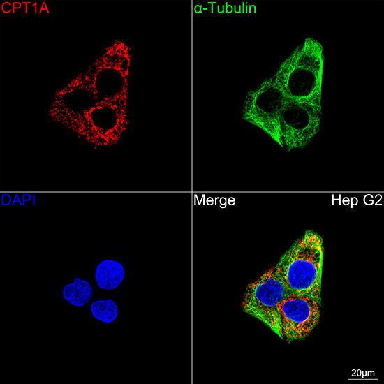 CPT1A Antibody in Immunocytochemistry (ICC/IF)