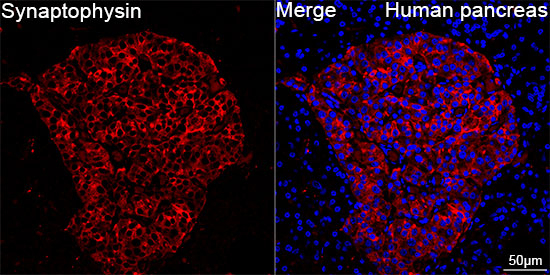 Synaptophysin Antibody in Immunohistochemistry (Paraffin) (IHC (P))