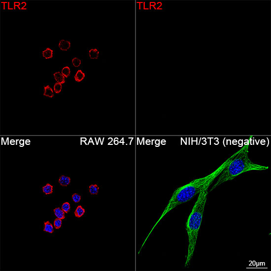 TLR2 Antibody in Immunocytochemistry (ICC/IF)