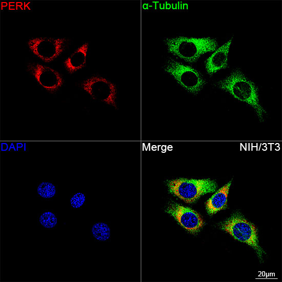 PERK Antibody in Immunocytochemistry (ICC/IF)