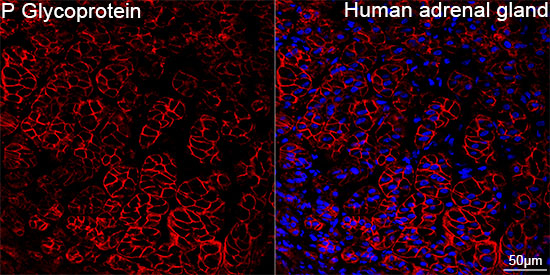 ABCB1 Antibody in Immunohistochemistry (Paraffin) (IHC (P))