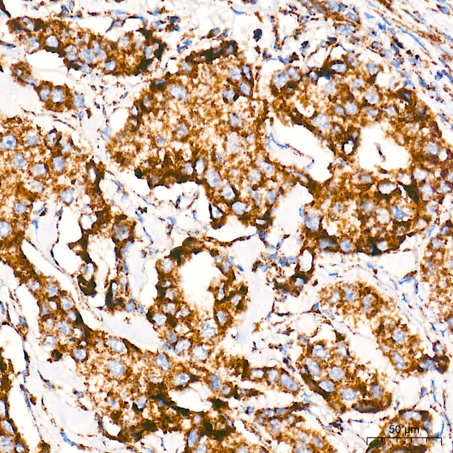 MT-ATP8 Antibody in Immunohistochemistry (Paraffin) (IHC (P))