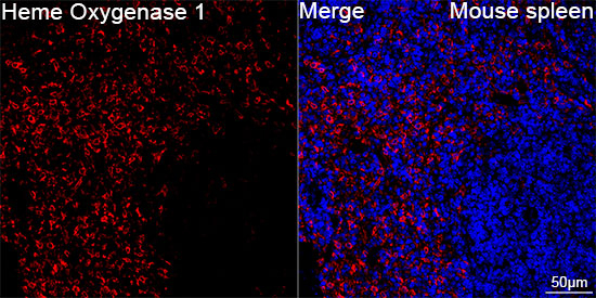 HO-1 Antibody in Immunohistochemistry (Paraffin) (IHC (P))